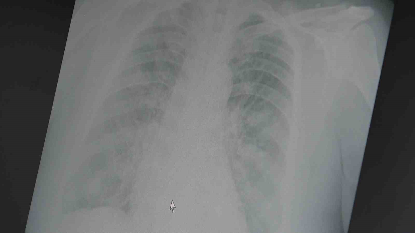 Profes&ouml;r uyardı: "Grip aşılarının etkinliği bu sezon d&uuml;ş&uuml;k"
