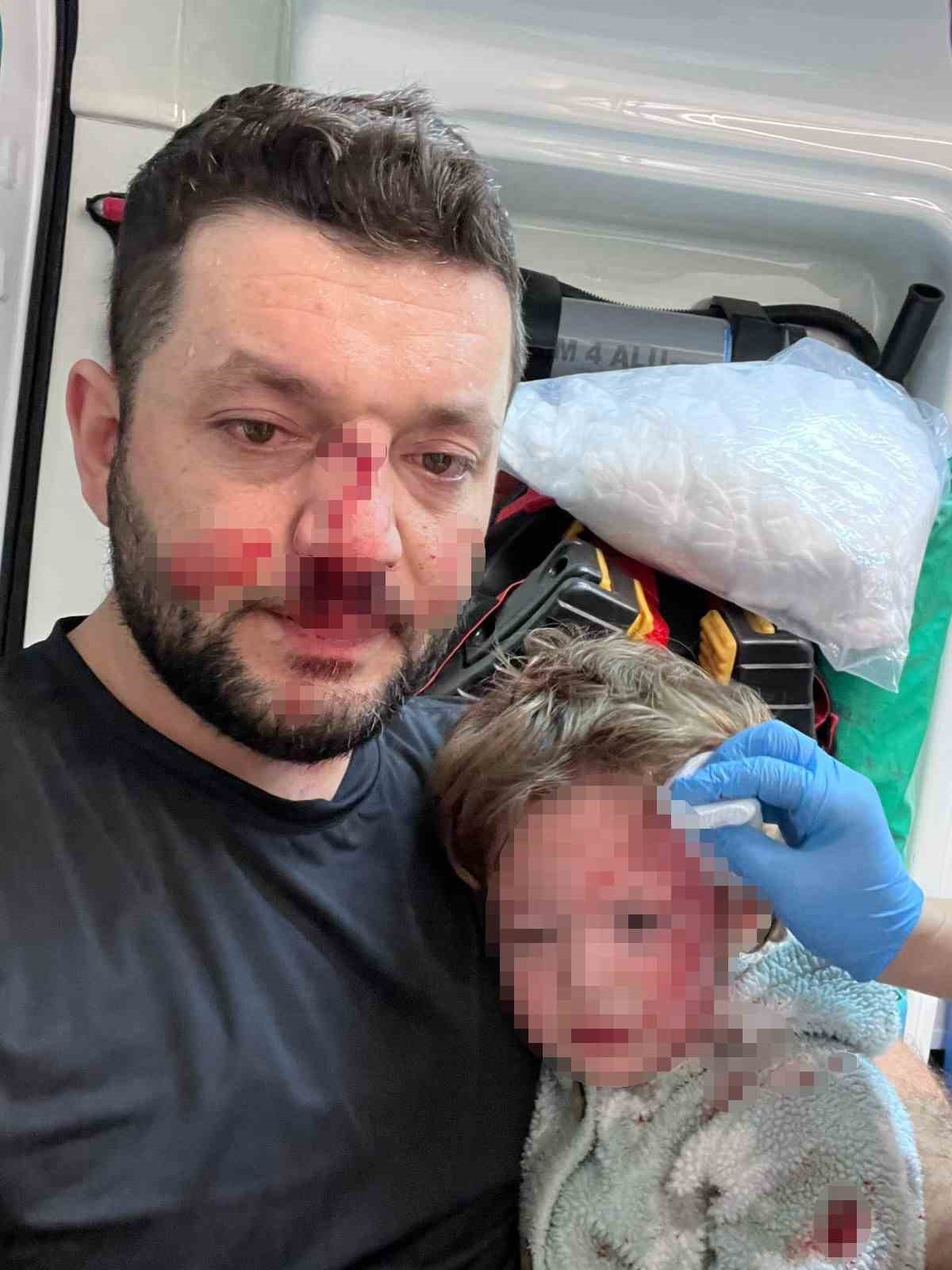 Yalova&rsquo;daki komşu kavgasında bu kez 8 yaşındaki &ccedil;ocuğa taşlı saldırı
