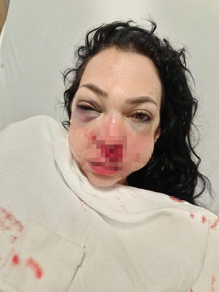 Anne ve oğlunun darp edilmesine ilişkin g&ouml;zaltına alınan 3 ş&uuml;pheliden 1&rsquo;i tutuklandı
