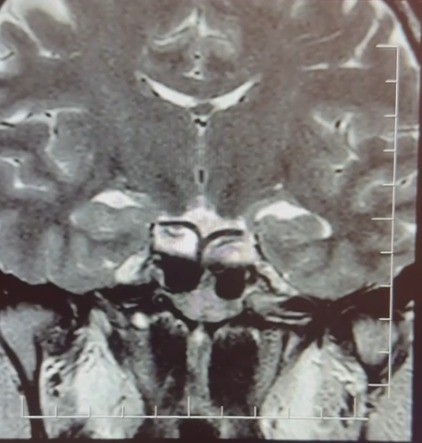 Hamileyim diye geldi, t&uuml;m&ouml;r teşhisi konuldu

