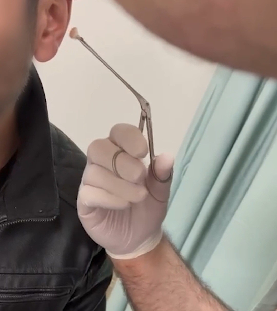 Kayseri’de kulağının içine uyuşturucu saklayan şüpheli yakalandı