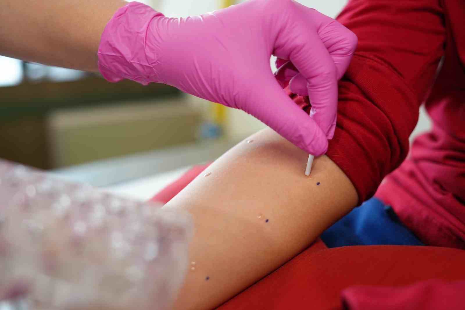 Baharla birlikte polen alerjisi alarmı
