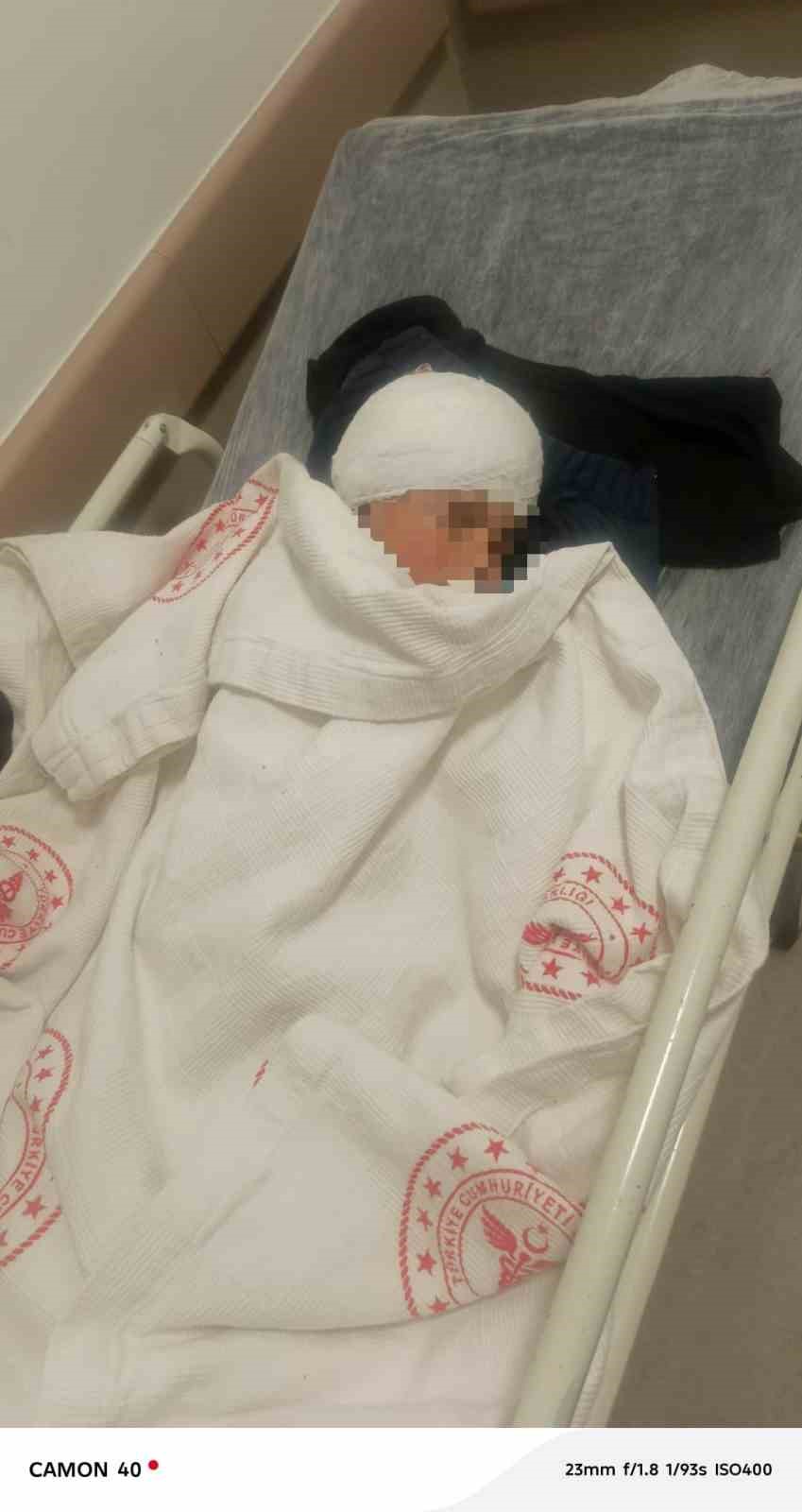 3 yaşındaki &ccedil;ocuğuna k&ouml;pek saldıran baba: "K&ouml;peğin &ccedil;ocuğumuzu bırakması i&ccedil;in &ccedil;ok uğraştık"
