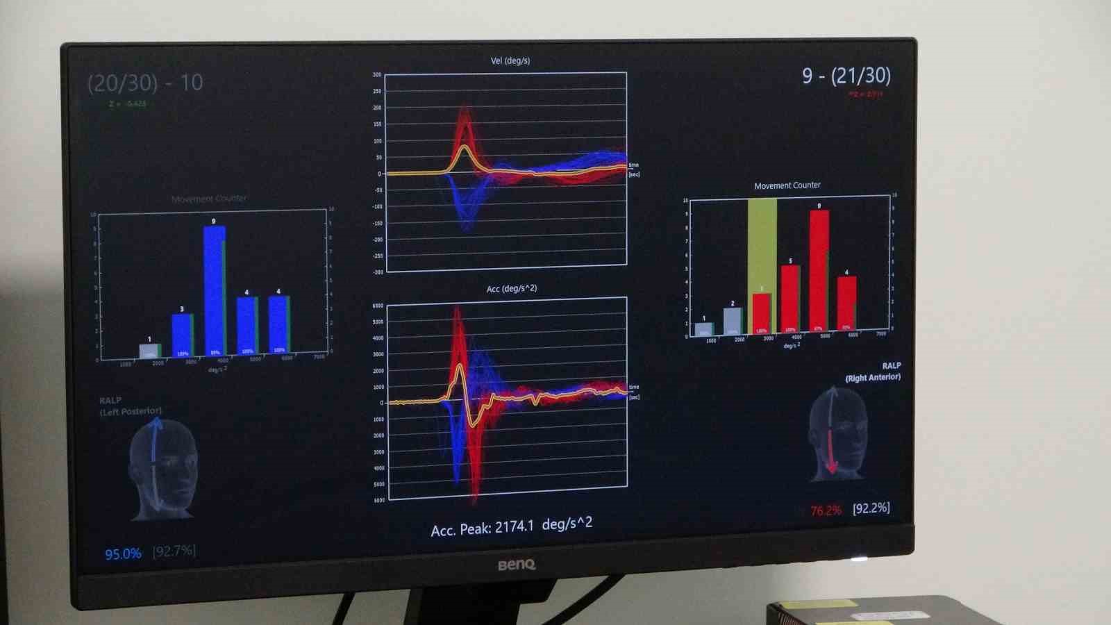 Malatya vertigo tedavisinde b&ouml;lgenin referans noktası
