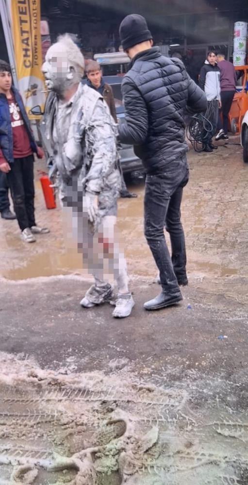 Ergani&rsquo;deki patlamada ağır yaralanan şahıs hayatını kaybetti
