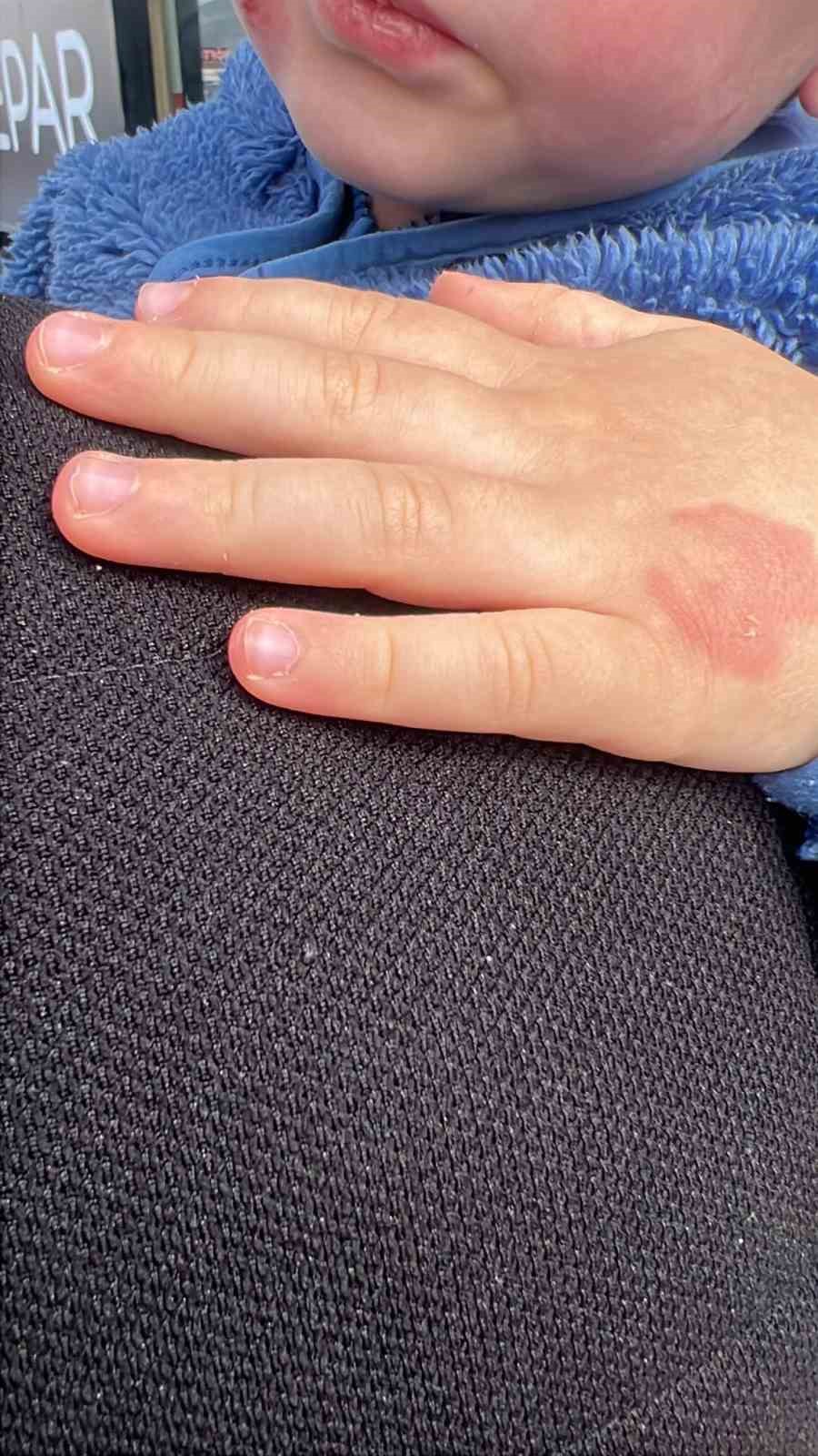 Kreşe bıraktığı &ccedil;ocuğunu darp edilmiş halde aldı
