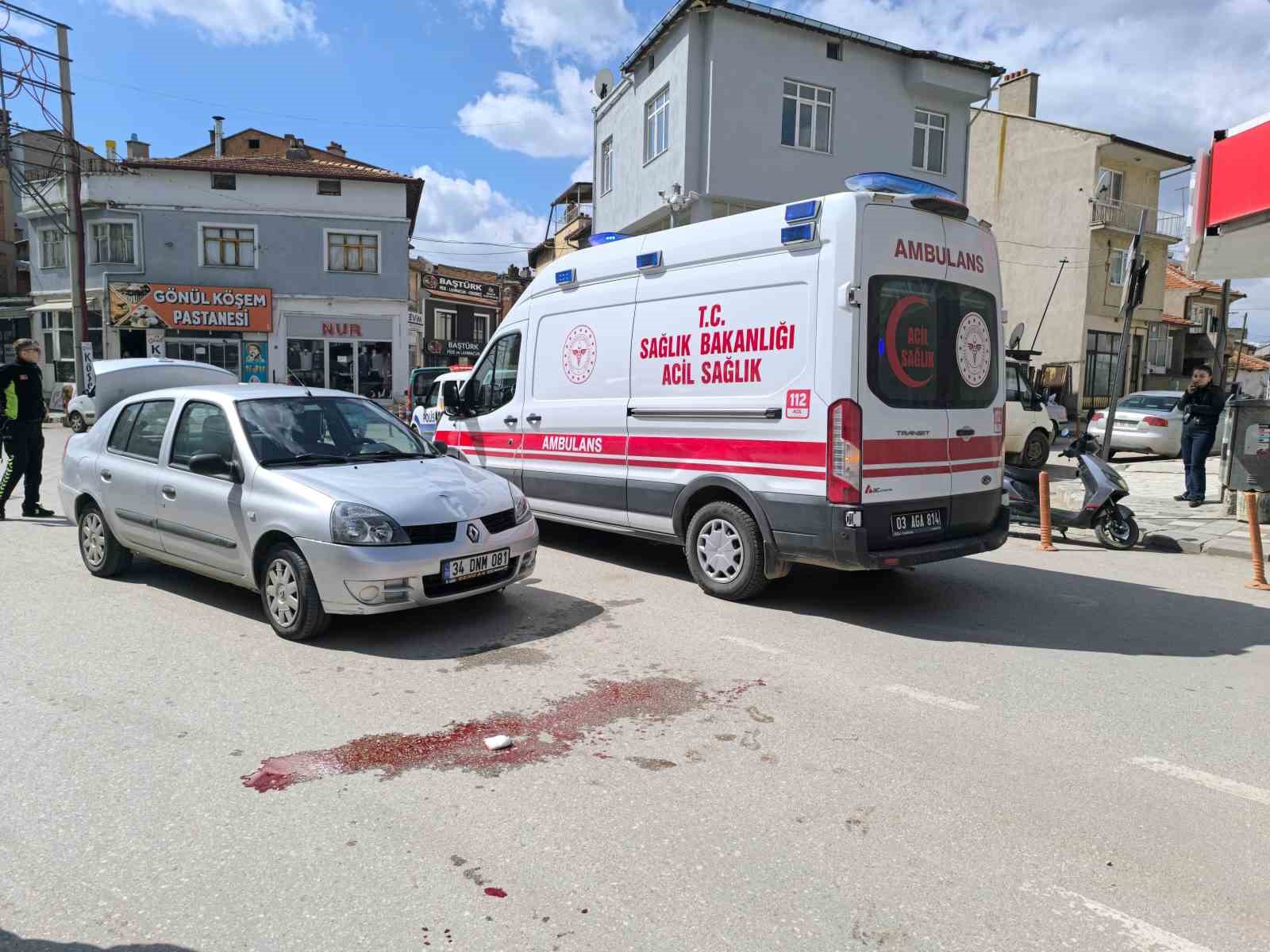 Otomobilin çarptığı yaya yaralandı