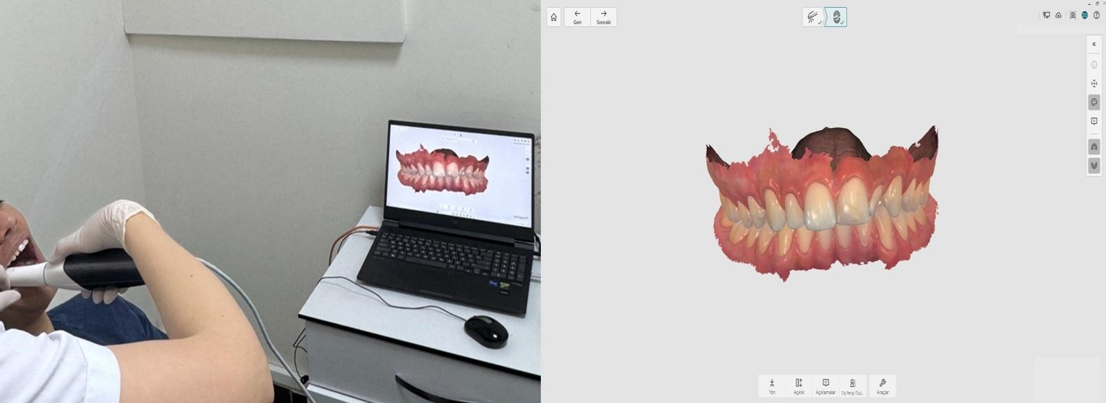 Zonguldak’ta Modern Ortodontik Tedavi Dönüşümü: BEUN Bölgeye Hizmet Sunuyor