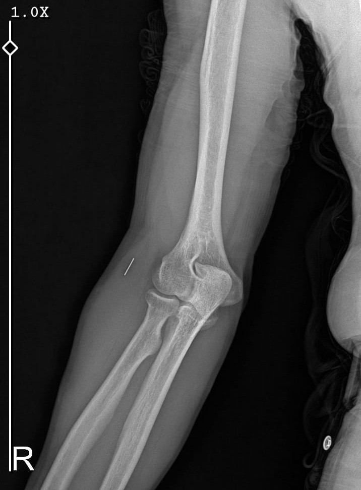 Kurban Bayramı&rsquo;nda parmağını kesti, başına gelmeyen kalmadı
