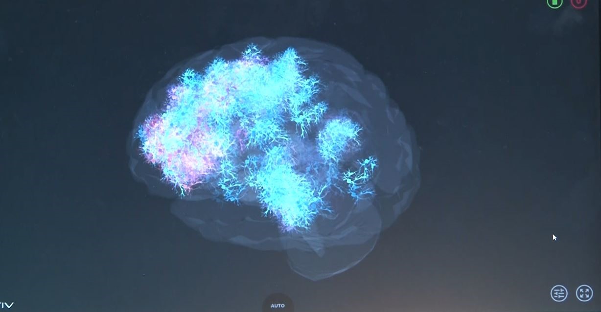 N&ouml;roloji uzmanından uyarı: "Sanal ortamdaki &ouml;ld&uuml;rme eylemleri zamanla ger&ccedil;ek hayata yansıyabiliyor"
