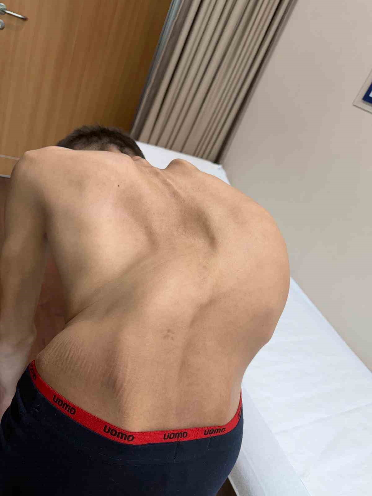 Kırgızistanlı gen&ccedil; şifayı T&uuml;rk hekimlerinde buldu
