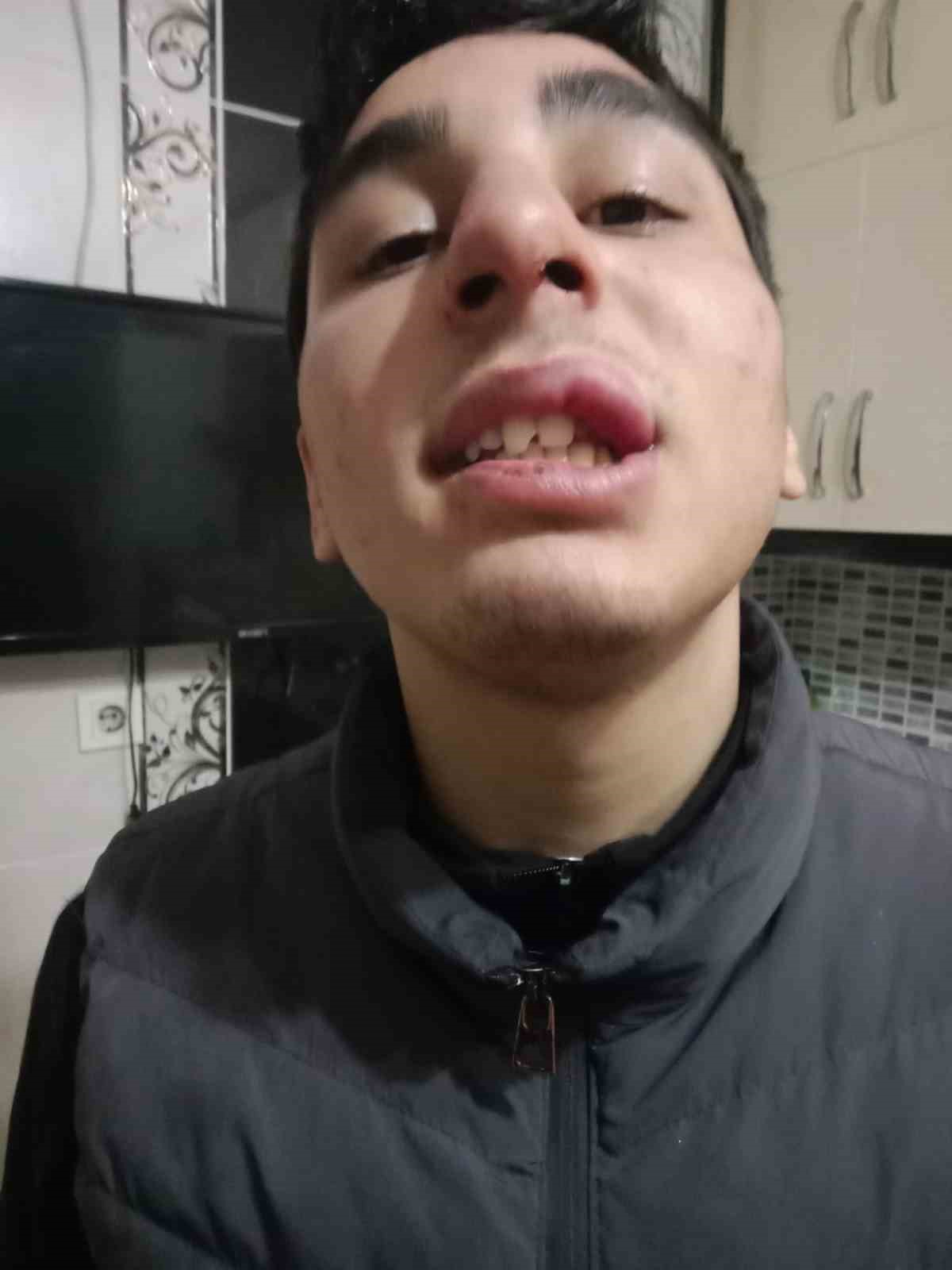 16 yaşındaki &ccedil;ocuk g&uuml;nd&uuml;z tartıştığı arkadaşının babası tarafından akşam darp edildi
