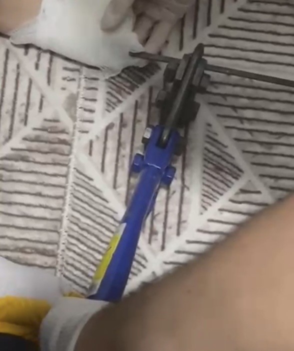 Osmaniye&rsquo;de ayağına mangal şişi saplanan &ccedil;ocuk hastaneye kaldırıldı
