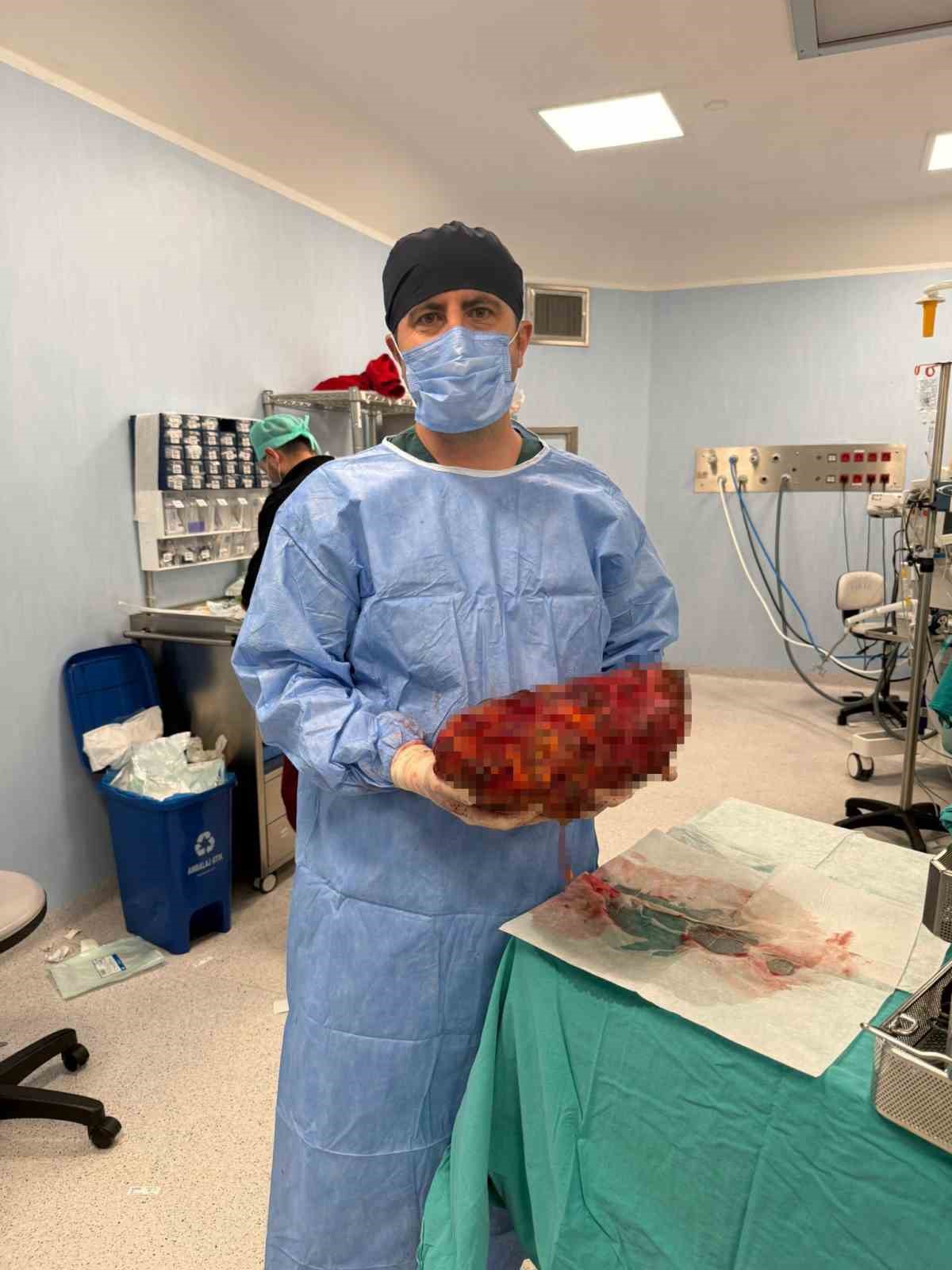 Karnında 8 kiloluk b&ouml;brekle yaşayan hasta, 30 dakikalık ameliyatla sağlığına kavuştu
