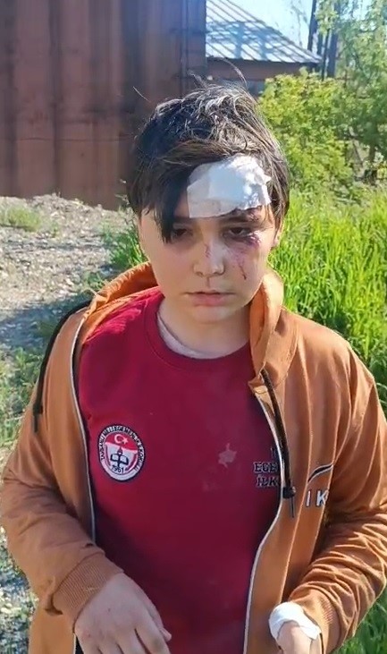 K&ouml;peklerden ka&ccedil;arken yaralanan arkadaşını sırtında taşıdı
