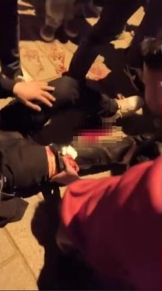 Esenyurt&rsquo;ta şampiyonluk kutlamasında bir taraftar bacağından bı&ccedil;aklandı
