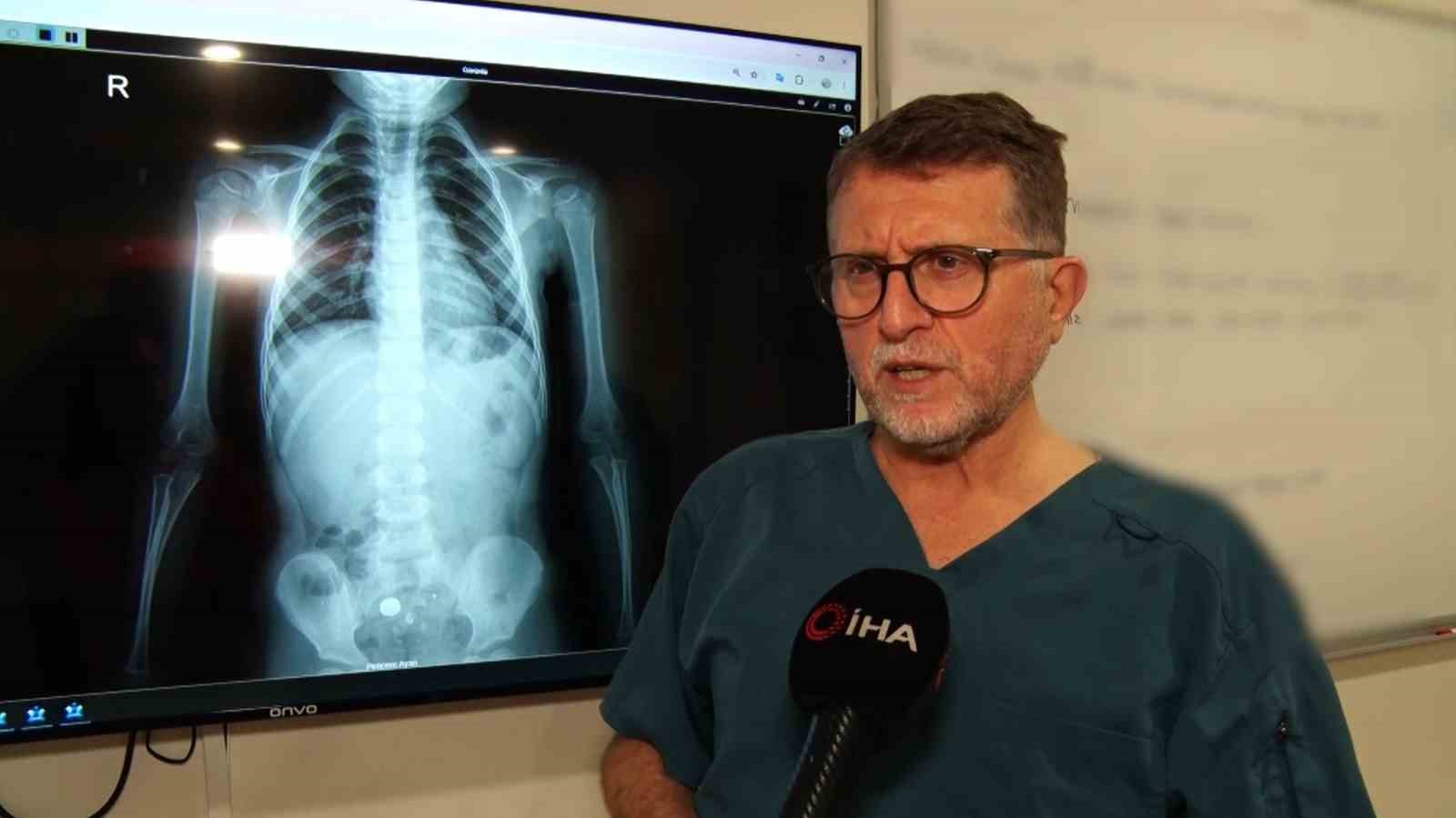 Şeker sanıp yuttu, pil olduğu filmde ortaya çıktı: "Ölüme kadar götürebiliyor"