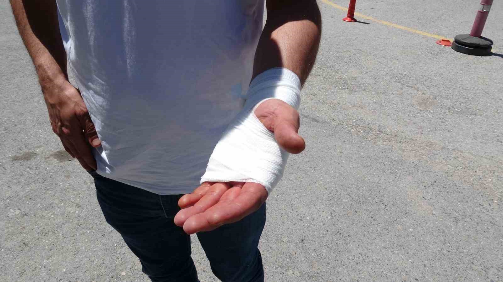 Malatya’da acemi kasaplar hastanelere koştu