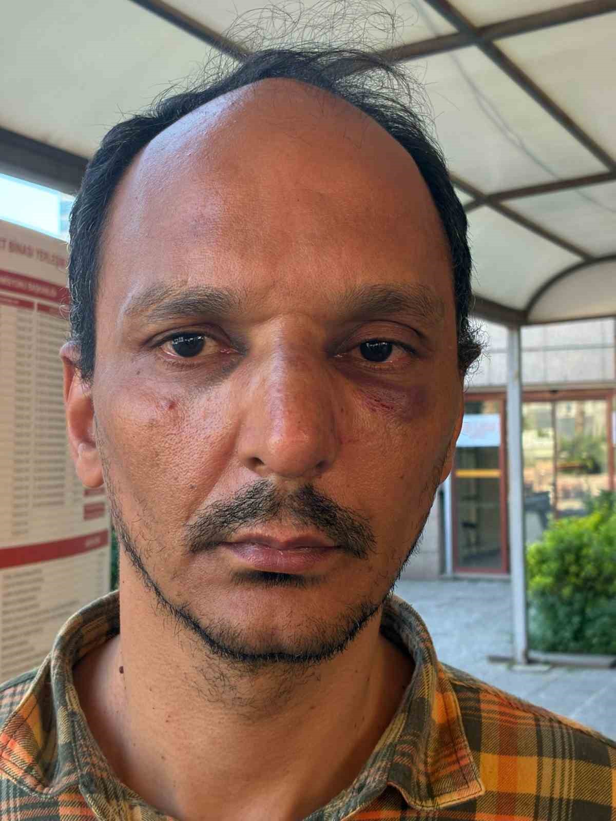 TOMA’nın üstüne çıkıp zarar veren saldırgan tutuklandı