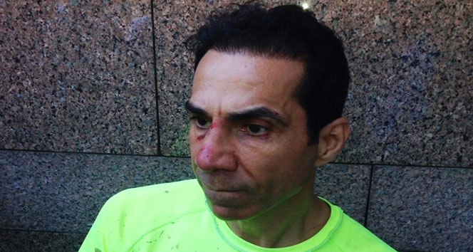 CHP’li Meclis üyesi saldırıya uğradı