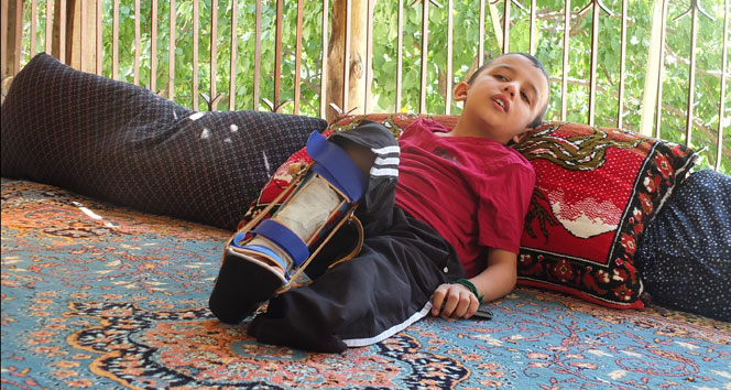 Elektrik akımına kapılan küçük Davut’un dramı