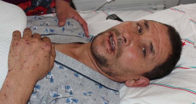 Zihinsel engelli Davut'un acı hikayesi