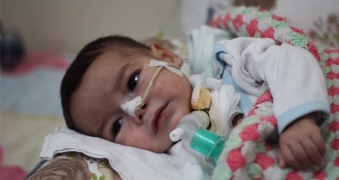 Minik Ceyhun’un dramı yürekleri dağlıyor