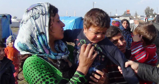Çadırlarda kalan Suriyeli çocuklarda &#039;Şark Çıbanı&#039;na rastlandı