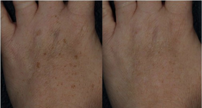 Amerika’da geliştirildi, tüm dünyaya yayıldı